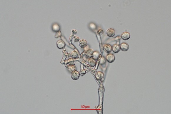 DIC microscopy