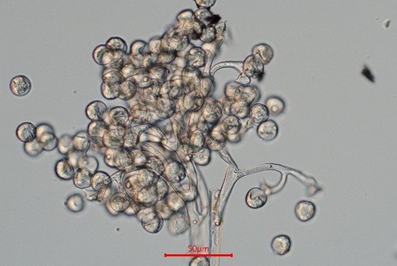 DIC microscopy