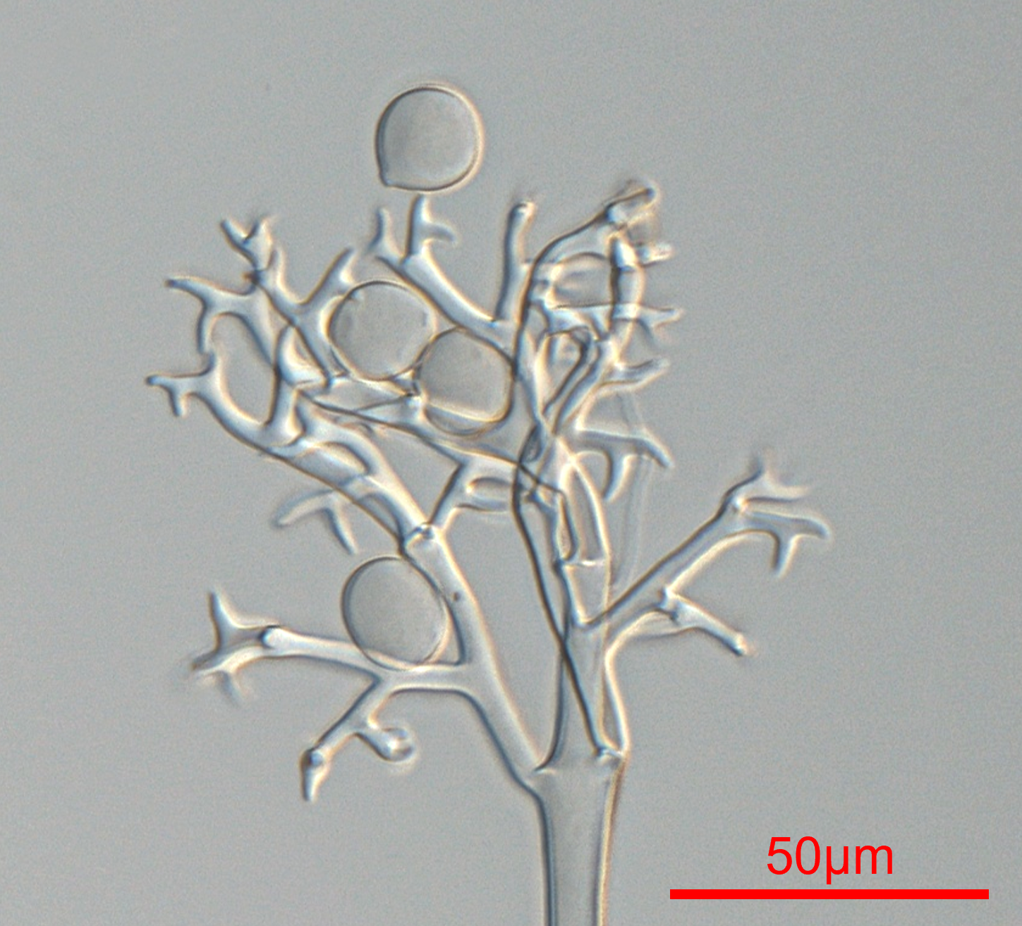 Downy mildew microscopy